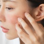 Asian,Young,Woman,Looking,Face,Skin,In,The,Mirror,Have